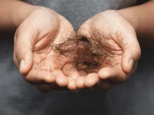 Hair Loss after weight loss surgery